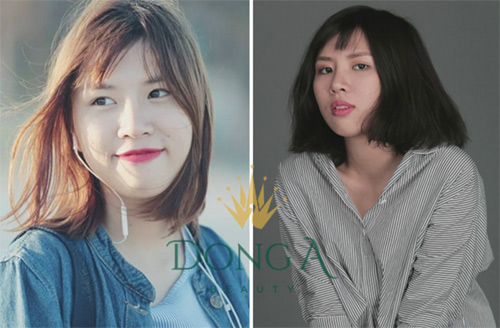 Giảm sâu 50% cho khách hàng làm đẹp tại Đông Á Beauty - 2