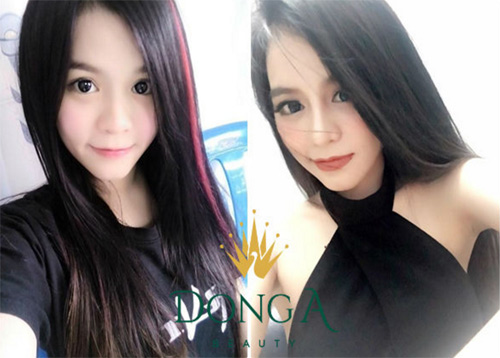 Giảm sâu 50% cho khách hàng làm đẹp tại Đông Á Beauty - 3