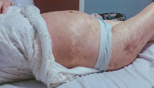 Ngày của Mẹ - Xem ảnh mẹ Việt chịu đau đớn “như gãy 20 cái xương sườn” đón con chào đời - 10