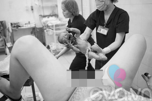 Ngày của Mẹ - Xem ảnh mẹ Việt chịu đau đớn “như gãy 20 cái xương sườn” đón con chào đời - 3