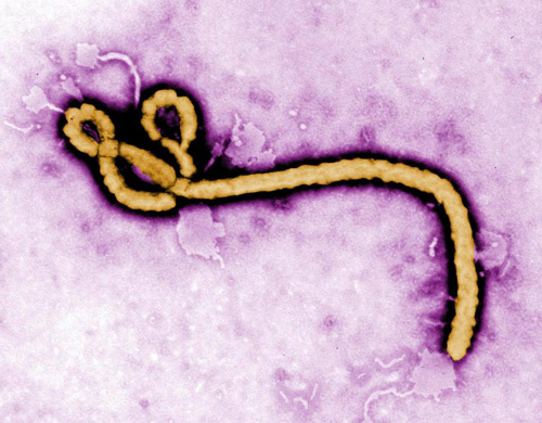 Tổ chức Y tế thế giới công bố đại dịch chết người Ebola bùng phát trở lại - 2