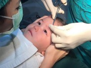 Làm mẹ - Bé gái mím môi quyết không khóc dù bác sĩ khâu sống khiến triệu người "thương ơi là thương"