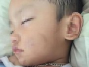 Tin tức - Nghi vấn bé trai 2 tuổi bị bạn trai của mẹ bạo hành dã man