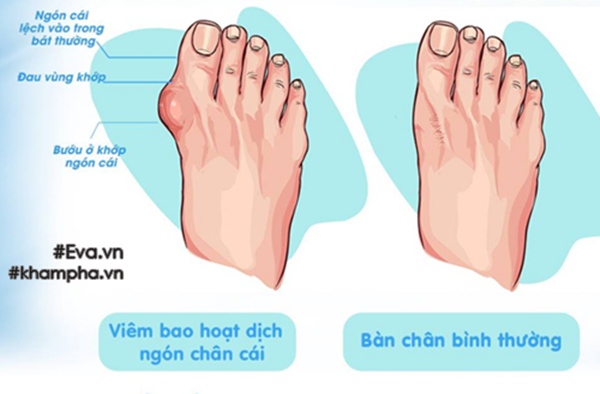 Con gái 1 tuổi kiếm 10 tỷ của đại gia Đoàn Di Băng được phát hiện bị tật ở bàn chân, bắt đầu tiến hành điều trị - 16