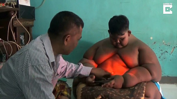 Bé trai mới 10 tuổi đã nặng 190kg vì nghiện ăn mỳ tôm và uống Coca - 1