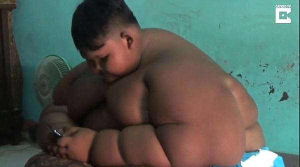 Bé trai mới 10 tuổi đã nặng 190kg vì nghiện ăn mỳ tôm và uống Coca - 2