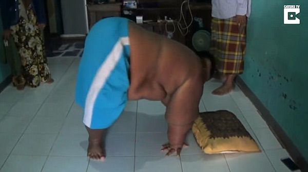 Bé trai mới 10 tuổi đã nặng 190kg vì nghiện ăn mỳ tôm và uống Coca - 3