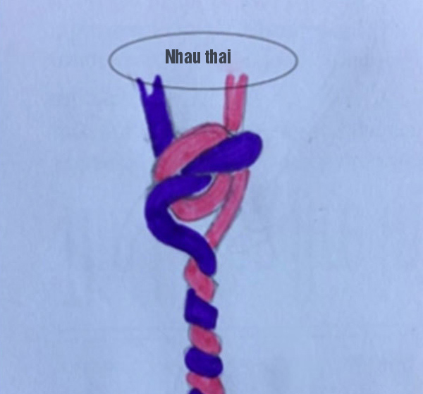 Mang bầu đôi nhưng sau siêu âm, bác sĩ dặn: “Đừng mua đồ cho con!” - 3