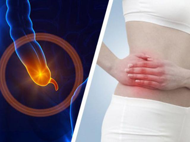 Viêm ruột thừa chậm 1 phút là nguy hiểm, phải chú ý các triệu chứng này ngay