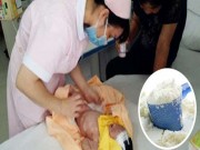 Làm mẹ - Bé sơ sinh phải cắt bỏ ruột vì sai lầm nghiêm trọng mà nhiều cha mẹ hay mắc phải
