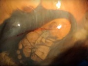 Bà bầu - 41 tuần mang bầu không một lần khám thai, người mẹ “hết hồn” khi bác sĩ mổ đẻ