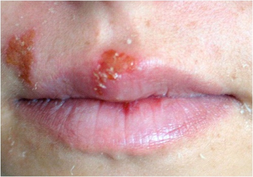 Các cô nàng, hãy thôi mê son rẻ kẻo hối tiếc cả đời! - 3