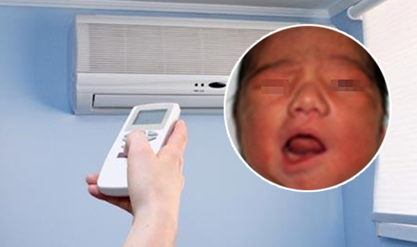 Bố mẹ bật điều hòa lạnh suốt đêm, con nhỏ bị liệt mặt, méo miệng - 1