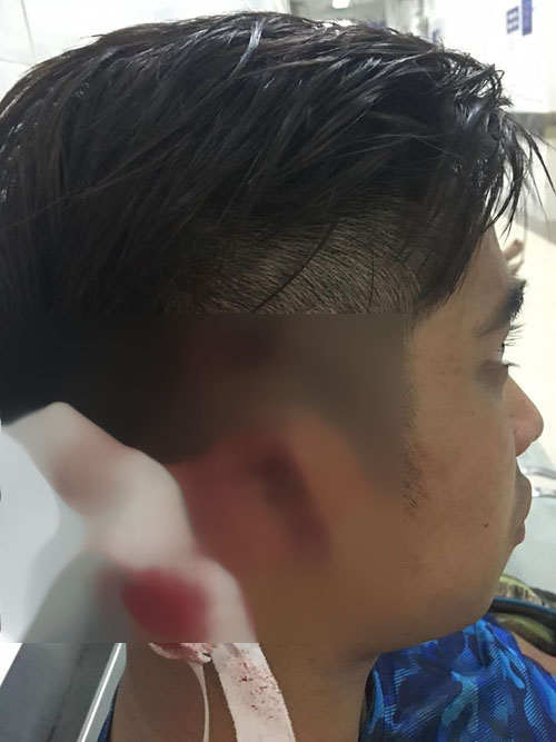 Trung tâm California Fitness amp; Yoga đình chỉ huấn luyện viên hành hung người tại phòng tập - 2