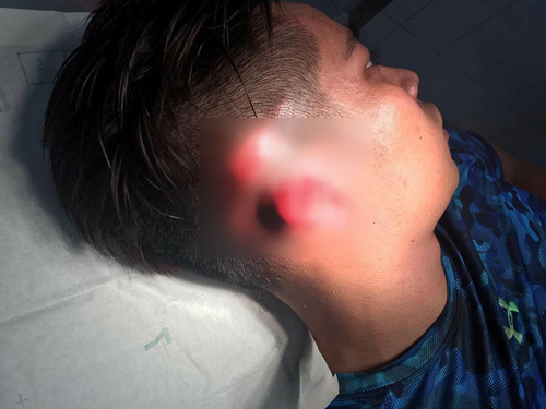 Trung tâm California Fitness amp; Yoga đình chỉ huấn luyện viên hành hung người tại phòng tập - 1