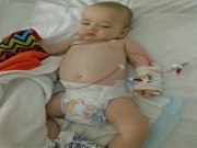 Làm mẹ - SỐC: Bé trai bị viêm màng não chỉ vì ngồi trong xe đẩy khi đi siêu thị cùng mẹ