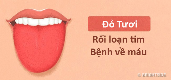 Màu lưỡi nói lên tình trạng sức khỏe của bạn thế nào? - 1