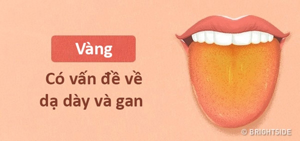 Màu lưỡi nói lên tình trạng sức khỏe của bạn thế nào? - 3