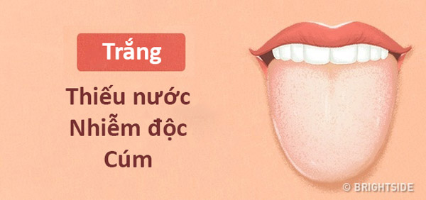 Màu lưỡi nói lên tình trạng sức khỏe của bạn thế nào? - 5