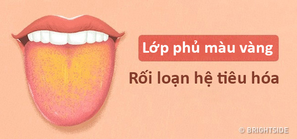 Màu lưỡi nói lên tình trạng sức khỏe của bạn thế nào? - 10