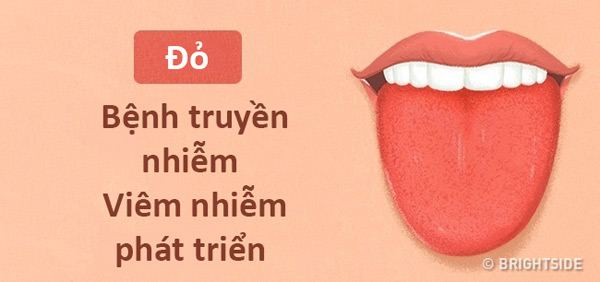 Màu lưỡi nói lên tình trạng sức khỏe của bạn thế nào? - 2