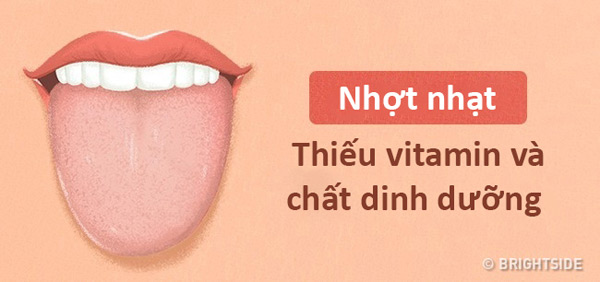 Màu lưỡi nói lên tình trạng sức khỏe của bạn thế nào? - 7