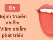 Sức khỏe - Màu lưỡi nói lên tình trạng sức khỏe của bạn thế nào?
