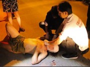 Tin tức - Người đàn ông khỏa thân rơi từ tầng 3 sau khi 'mây mưa' với gái mại dâm trong khách sạn