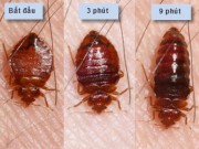 Nhà đẹp - Phát hoảng với loài sinh vật hút máu xuất hiện nếu lười giặt ga trải giường