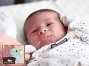 Làm mẹ - Cách xử lý trẻ bị sặc sữa "một phát khỏi ngay" nhưng nhiều mẹ chưa biết