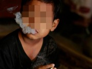 Làm mẹ - Bé trai "2 mặt" phải dùng dầu cần sa suốt 2 năm và nghị lực sống hơn 1 thập kỷ qua