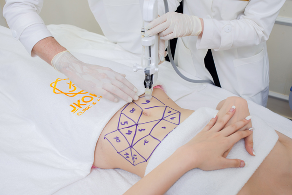 Bí quyết giảm cân an toàn sau 2 tuần của cô gái Hà Nội - 2