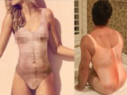 Thời trang - Chị em "khóc thét" với sản phẩm áo tắm lông lá chống nạn hiếp dâm