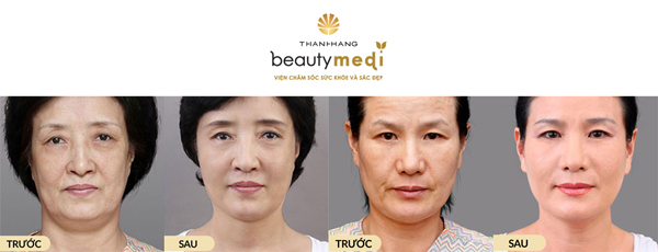 Da mặt mịn đẹp như mơ chỉ nhờ một sợi chỉ bé xíu - 2