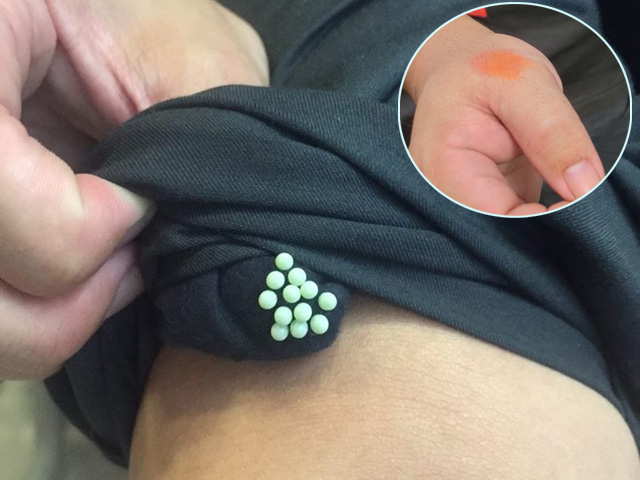 Rút quần áo phơi ở ngoài vào nếu thấy thứ này thì tuyệt đối đừng chủ quan