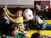 Làm mẹ - Nghẹn lòng khi nhìn bộ mặt thật của bé 8 tuổi bị bạn xa lánh vì luôn đeo mặt nạ đi học