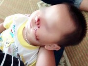 Tin tức - Thực hư việc bé trai 2 tuổi bị bố say rượu chém vào mặt