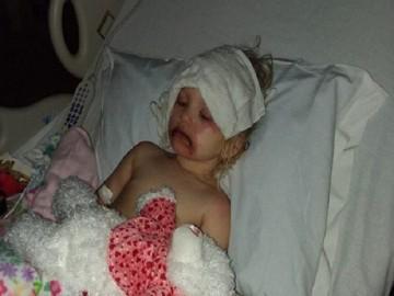 Bé gái biến dạng mặt, nhập viện sau trò chơi trang điểm