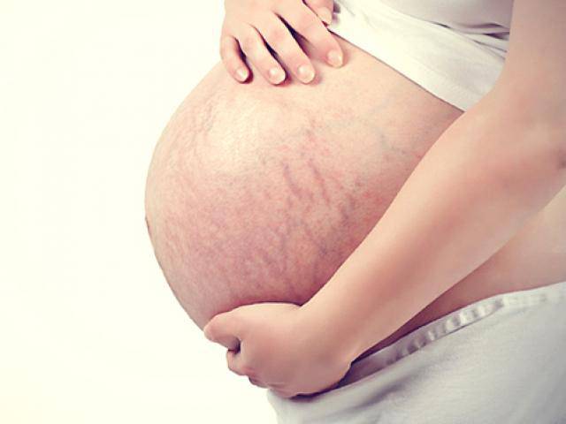 Ngỡ ngàng trước thái độ của người chồng khi nữ thư ký gửi ảnh bụng rạn chằng chịt của vợ