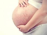 Eva tám - Ngỡ ngàng trước thái độ của người chồng khi nữ thư ký gửi ảnh bụng rạn chằng chịt của vợ
