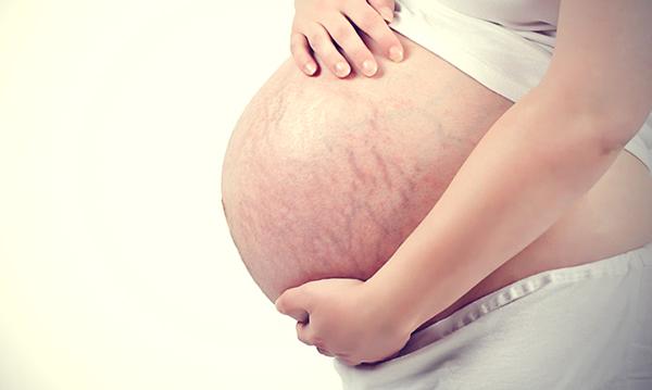 Ngỡ ngàng trước thái độ của người chồng khi nữ thư ký gửi ảnh bụng rạn chằng chịt của vợ - 2