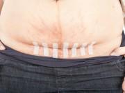 Bà bầu - Mẹ sinh mổ phải nhớ những quy tắc ăn uống này cho nhanh khỏe, vết mổ đẹp