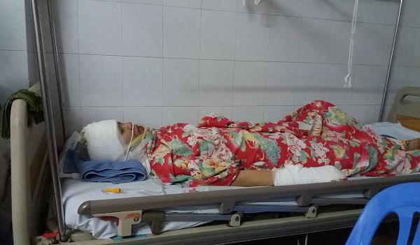 Người vợ bị chồng cũ tạt axit vì ghen tuông: “Con tha thứ và không muốn anh ấy đi tù” - 1