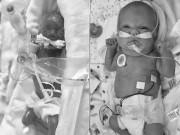 Bà bầu - Sự "chuyển mình" đáng kinh ngạc của cô bé sinh non 23 tuần khiến ai cũng xúc động