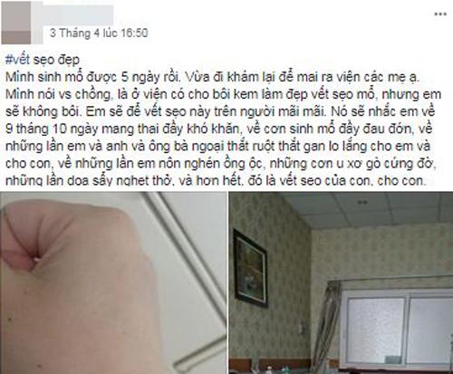 Mẹ Hải Dương không muốn bôi kem làm liền sẹo mổ, khi biết lý do ai cũng nghẹn lòng - 1