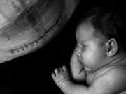 Bà bầu - Mẹ Hải Dương không muốn bôi kem làm liền sẹo mổ, khi biết lý do ai cũng nghẹn lòng