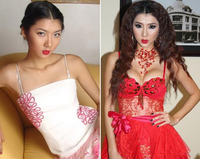 Im lặng hay phủ nhận amp;#34;dao kéoamp;#34;, thì vết sẹo kì lạ này cũng đã lên tiếng thay chủ nhân! - 11