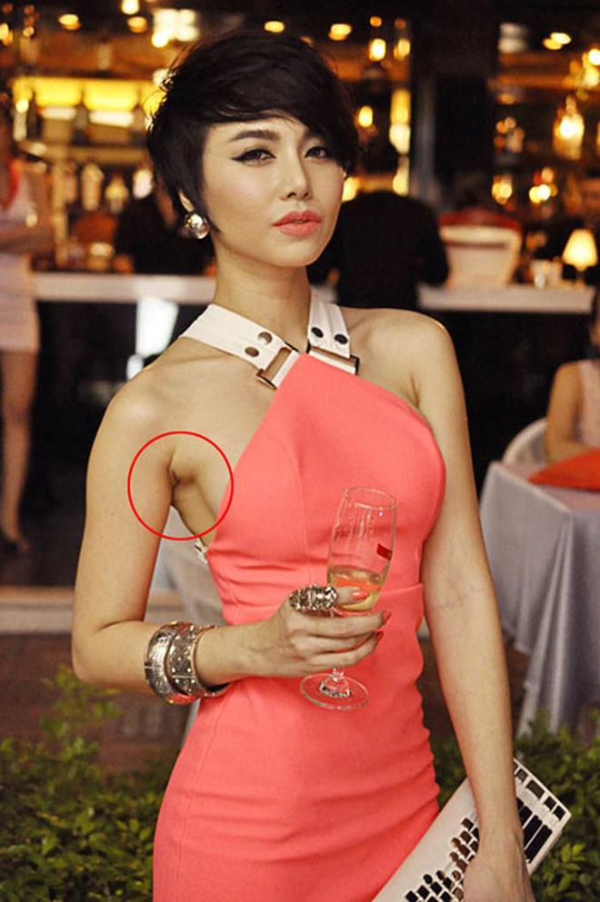 Im lặng hay phủ nhận amp;#34;dao kéoamp;#34;, thì vết sẹo kì lạ này cũng đã lên tiếng thay chủ nhân! - 13