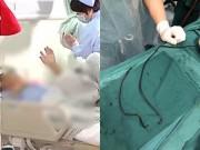 Chuyện lạ - Kinh hãi người đàn ông nhét dây cáp dài gần 1m vào "chỗ hiểm" cho...đỡ ngứa