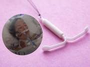 Bà bầu - Vừa cấy vòng tránh thai, mẹ trẻ bị chảy máu vùng kín suýt chết và không thể mang thai lại